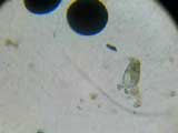 Brachionus plicatilis ancré sur une lame de microscope