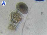 A-brachionus-plicatilis A-brachionus-plicatilis